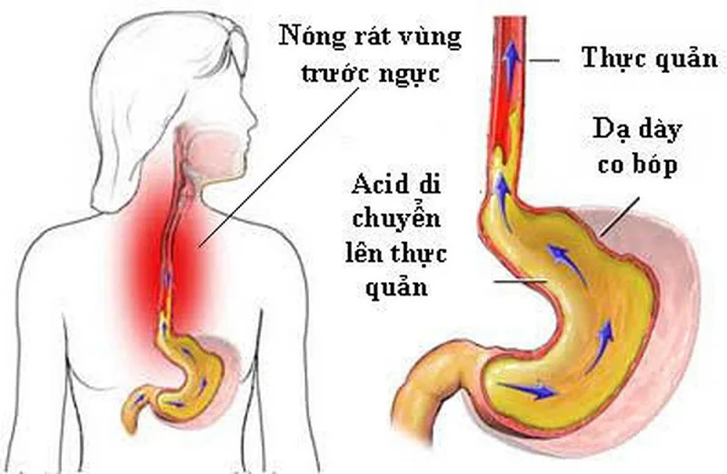 trao nguoc da day kieng an gi