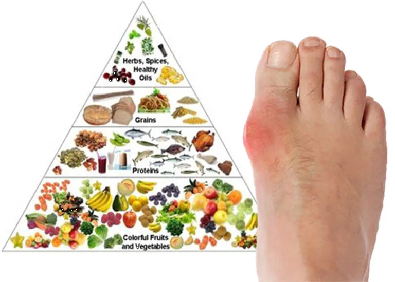 suc-khoe-nguoi-bi-gout-kieng-an-gi-a1